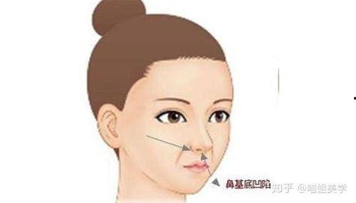 鼻基底凹陷的明星网红,揭秘他们的美丽秘诀